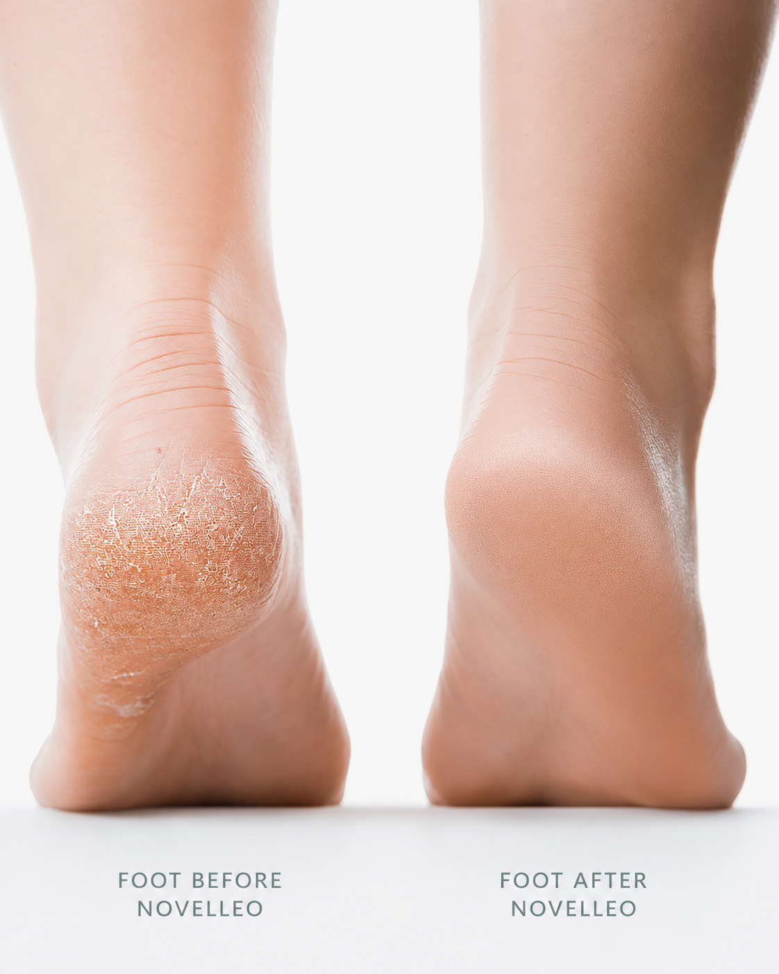 Novelleo Smooth Pro